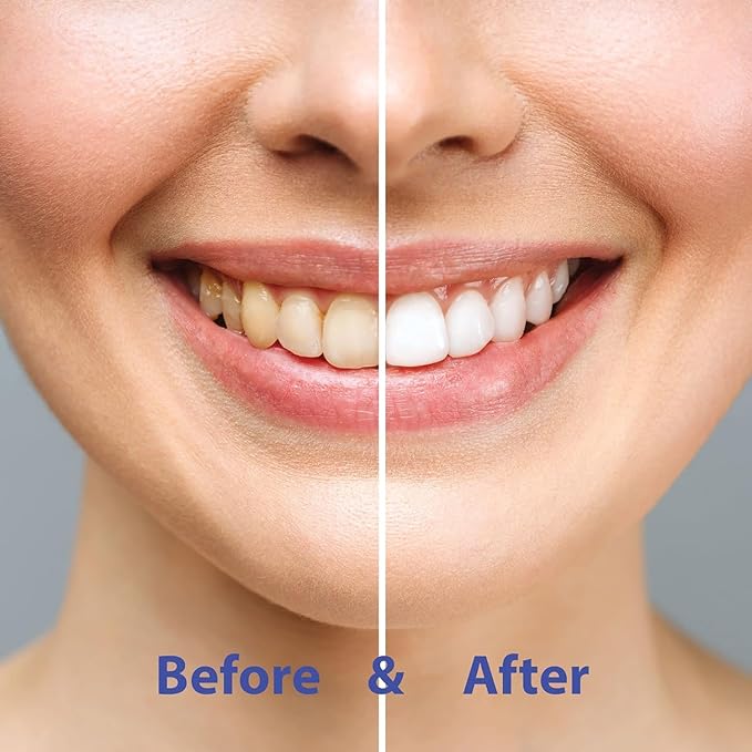 CHOMP Cinnamon Toothpaste Tablets Refills with Flossing Toothbrush