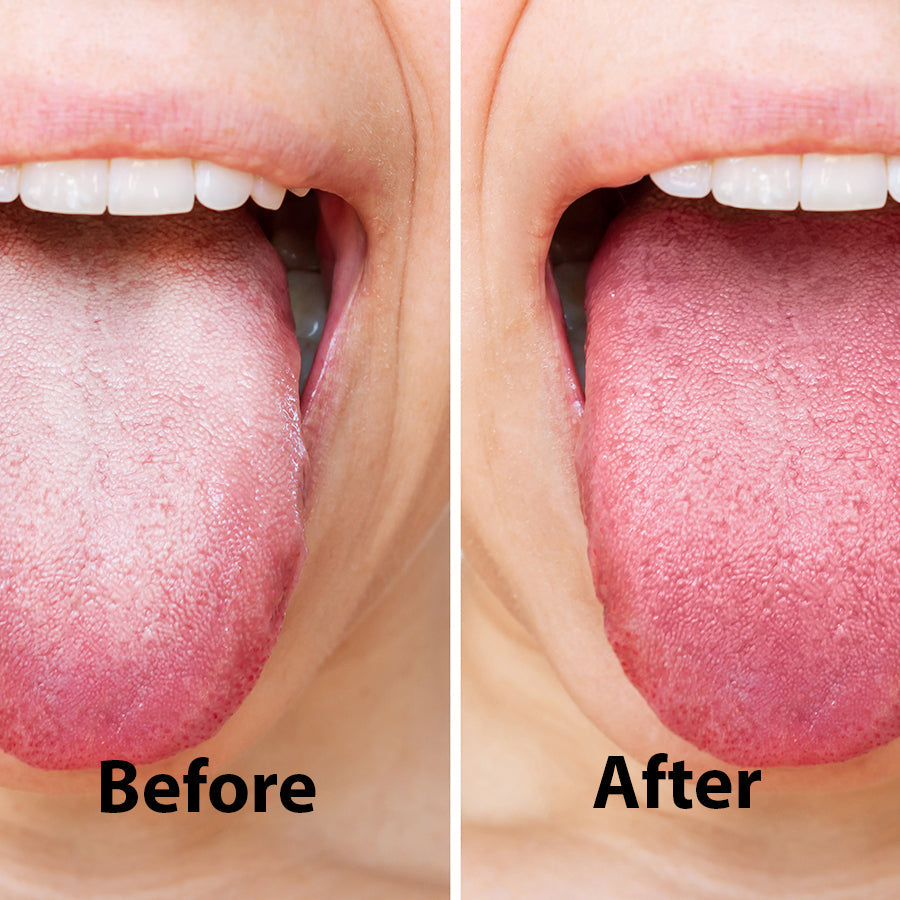 Stainless Steel Tongue Scraper
